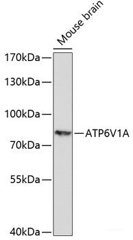Immunofluorescence analysis of L929 cells using ACSS1 Polyclonal Antibody at dilution of  1:100. Blue: DAPI for nuclear staining.