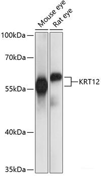 Immunofluorescence analysis of HeLa cells using SLC25A4 Polyclonal Antibody at dilution of  1:100 (40x lens). Blue: DAPI for nuclear staining.