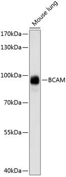 Immunofluorescence analysis of U2OS cells using SLC25A6 Polyclonal Antibody at dilution of  1:100. Blue: DAPI for nuclear staining.