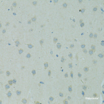 Immunofluorescence analysis of U2OS cells using ARSF Polyclonal Antibody at dilution of  1:100. Blue: DAPI for nuclear staining.