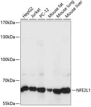Immunohistochemistry of paraffin-embedded Human liver using CD68 Polyclonal Antibody at dilution of  1:200 (40x lens).