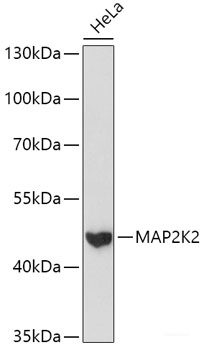 Immunofluorescence analysis of HeLa cells using CYP2J2 Polyclonal Antibody at dilution of  1:100 (40x lens). Blue: DAPI for nuclear staining.