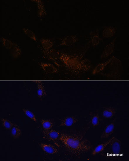 Immunofluorescence analysis of U2OS cells using CYP11B1 Polyclonal Antibody at dilution of  1:100. Blue: DAPI for nuclear staining.