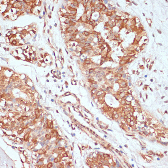 Immunofluorescence analysis of C6 cells using DCN Polyclonal Antibody at dilution of  1:100 (40x lens). Blue: DAPI for nuclear staining.