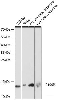 Immunofluorescence analysis of U2OS cells using GSTM3 Polyclonal Antibody at dilution of  1:100. Blue: DAPI for nuclear staining.