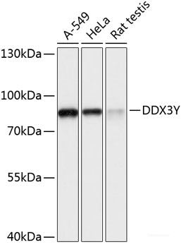 Immunohistochemistry of paraffin-embedded Rat lung using ITGAX Polyclonal Antibody at dilution of  1:100 (40x lens).