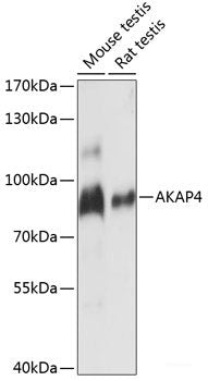 Immunofluorescence analysis of U2OS cells using PFKL Polyclonal Antibody at dilution of  1:100. Blue: DAPI for nuclear staining.