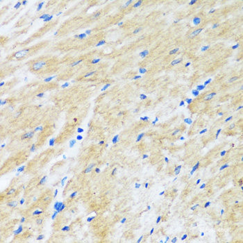 Immunohistochemistry of paraffin-embedded Mouse retina using RHO Polyclonal Antibody at dilution of  1:200 (40x lens).