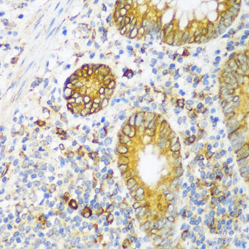 Immunohistochemistry of paraffin-embedded Rat bone marrow using TGFB1 Polyclonal Antibody at dilution of  1:100 (40x lens).