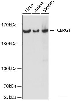 Immunofluorescence analysis of U2OS cells using TRAF3 Polyclonal Antibody at dilution of  1:100. Blue: DAPI for nuclear staining.