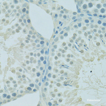 Immunofluorescence analysis of HeLa cells using TRPC6 Polyclonal Antibody at dilution of  1:100 (40x lens). Blue: DAPI for nuclear staining.