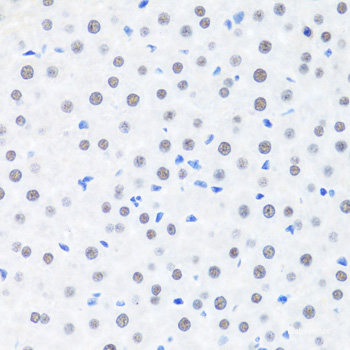 Immunofluorescence analysis of HeLa cells using CXCR4 Polyclonal Antibody at dilution of  1:100 (40x lens). Blue: DAPI for nuclear staining.