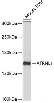 Immunofluorescence analysis of U2OS cells using FZD4 Polyclonal Antibody at dilution of  1:100. Blue: DAPI for nuclear staining.