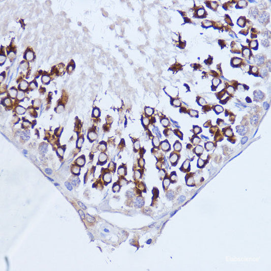 Immunohistochemistry of paraffin-embedded Rat spleen using CDC23 Polyclonal Antibody at dilution of  1:100 (40x lens).