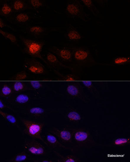 Immunofluorescence analysis of U2OS cells using MAP4K5 Polyclonal Antibody at dilution of  1:100. Blue: DAPI for nuclear staining.