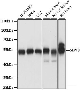 Immunofluorescence analysis of Hela cells using ZNF408 Polyclonal Antibody at dilution of  1:100 (40x lens). Blue: DAPI for nuclear staining.