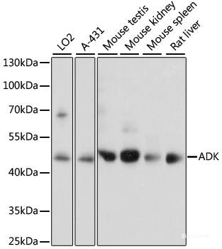 Immunofluorescence analysis of U2OS cells using ALG2 Polyclonal Antibody at dilution of  1:100. Blue: DAPI for nuclear staining.