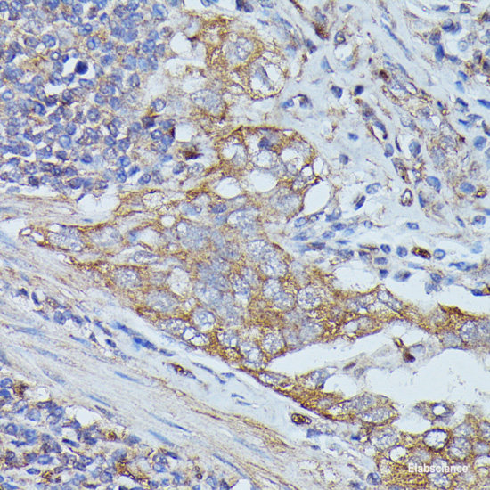 Immunofluorescence analysis of U-2 OS cells using GTF2E1 Polyclonal Antibody at dilution of  1:100 (40x lens). Blue: DAPI for nuclear staining.