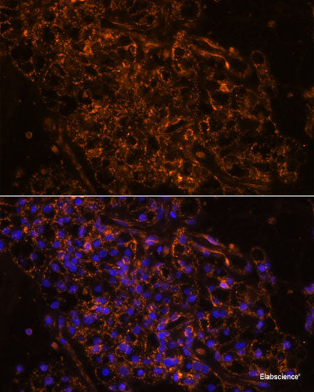 Immunofluorescence analysis of L929 cells using MTMR4 Polyclonal Antibody at dilution of  1:100 (40x lens). Blue: DAPI for nuclear staining.