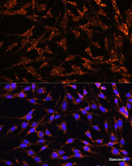 Immunofluorescence analysis of C6 cells using FARSB Polyclonal Antibody at dilution of  1:100. Blue: DAPI for nuclear staining.