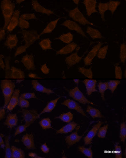 Immunofluorescence analysis of C6 cells using SEC23IP Polyclonal Antibody at dilution of  1:100. Blue: DAPI for nuclear staining.