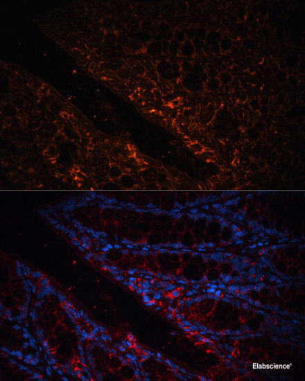 Immunohistochemistry of paraffin-embedded Human stomach using TNFR1 Polyclonal Antibody at dilution of  1:100 (40x lens).