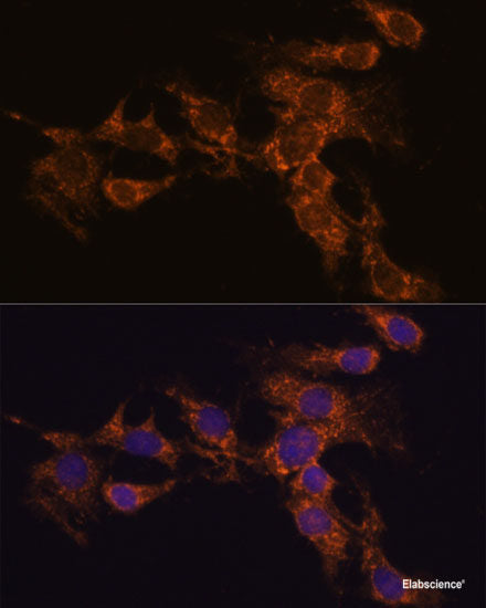 Immunofluorescence analysis of L929 cells using VILL Polyclonal Antibody at dilution of  1:100. Blue: DAPI for nuclear staining.
