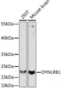 Immunofluorescence analysis of Rat testis using TPD52L3 Polyclonal Antibody at dilution of  1:100. Blue: DAPI for nuclear staining.