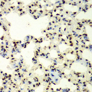 Immunofluorescence analysis of C6 cells using IPO4 Polyclonal Antibody at dilution of  1:100. Blue: DAPI for nuclear staining.