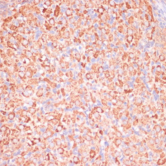 Immunofluorescence analysis of MCF-7 cells using beta 2 Microglobulin Polyclonal Antibody
