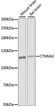 Immunohistochemistry of paraffin-embedded Human breast using Acetyl-Histone H2A-K5 Polyclonal Antibody at dilution of  1:100 (40x lens).