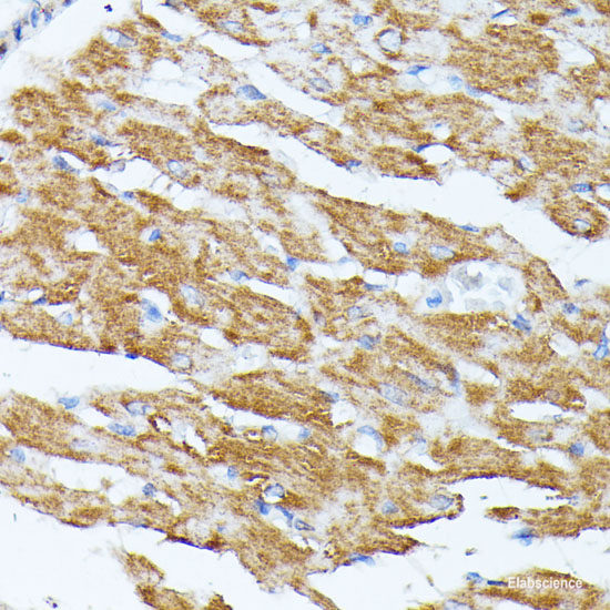 Immunohistochemistry of paraffin-embedded Rat brain using RNF149 Polyclonal Antibody at dilution of  1:100 (40x lens).