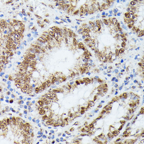 Immunofluorescence analysis of HeLa cells using CANX Polyclonal Antibody at dilution of  1:100. Blue: DAPI for nuclear staining.