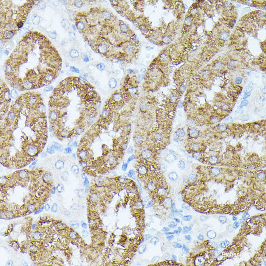 Immunohistochemistry of paraffin-embedded Rat heart using SLC25A5 Polyclonal Antibody at dilution of  1:100 (40x lens).