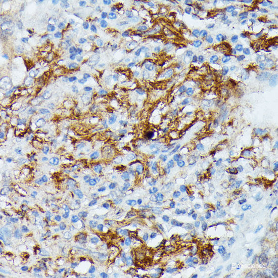 Immunofluorescence analysis of U2OS cells using RHOA Polyclonal Antibody at dilution of  1:100. Blue: DAPI for nuclear staining.