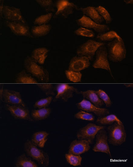 Immunofluorescence analysis of U2OS cells using ATM Polyclonal Antibody at dilution of  1:100. Blue: DAPI for nuclear staining.