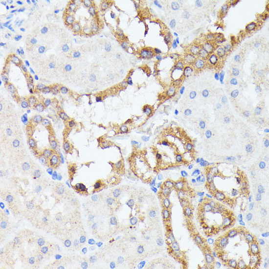 Immunohistochemistry of paraffin-embedded Rat bone marrow using CAMP Polyclonal Antibody at dilution of  1:200 (40x lens).