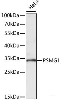 Immunohistochemistry of paraffin-embedded Rat brain using ENTPD6 Polyclonal Antibody at dilution of  1:100 (40x lens).