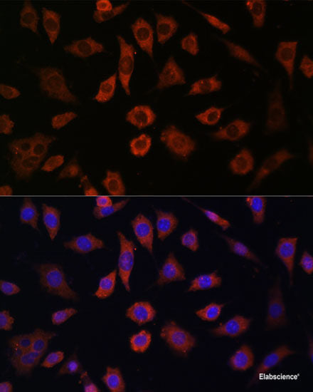 Immunohistochemistry of paraffin-embedded Human liver damage using BSG Polyclonal Antibody at dilution of  1:200 (40x lens).