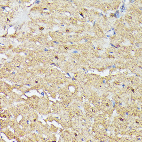 Immunofluorescence analysis of U2OS cells using CSF3 Polyclonal Antibody at dilution of  1:100. Blue: DAPI for nuclear staining.