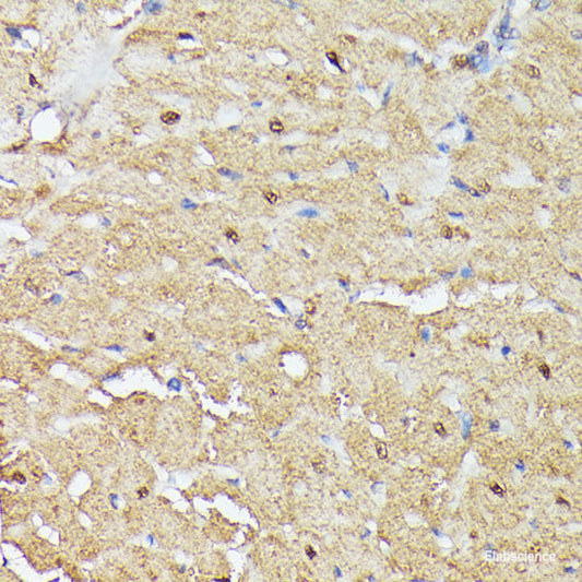 Immunofluorescence analysis of U2OS cells using CSF3 Polyclonal Antibody at dilution of  1:100. Blue: DAPI for nuclear staining.