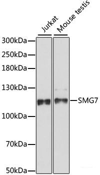 Immunofluorescence analysis of U2OS cells using GNAI3 Polyclonal Antibody at dilution of  1:100. Blue: DAPI for nuclear staining.