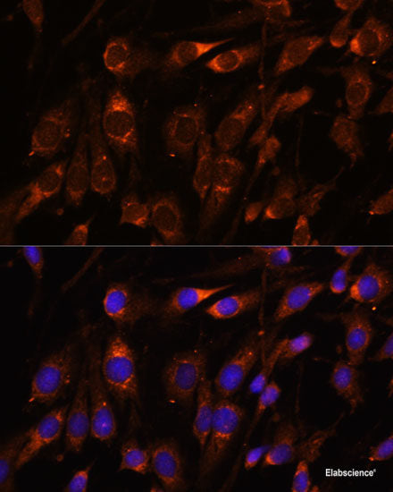 Immunohistochemistry of paraffin-embedded Rat liver using HNRNPD Polyclonal Antibody at dilution of  1:100 (40x lens).