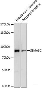 Immunofluorescence analysis of U2OS cells using MMP14 Polyclonal Antibody at dilution of  1:100. Blue: DAPI for nuclear staining.
