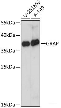 Immunofluorescence analysis of L929 cells using NDUFA4 Polyclonal Antibody at dilution of  1:100 (40x lens). Blue: DAPI for nuclear staining.