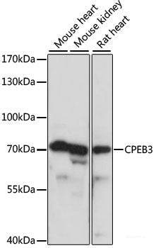 Immunofluorescence analysis of U2OS cells using PRKAB1 Polyclonal Antibody at dilution of  1:100. Blue: DAPI for nuclear staining.