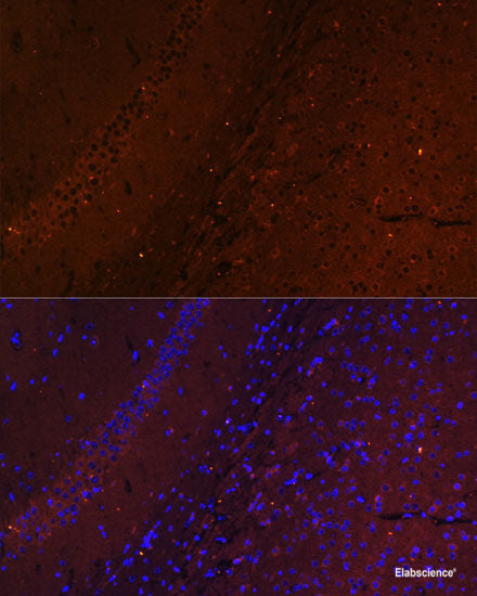 Immunohistochemistry of paraffin-embedded Human placenta using RPS13 Polyclonal Antibody at dilution of  1:100 (40x lens).