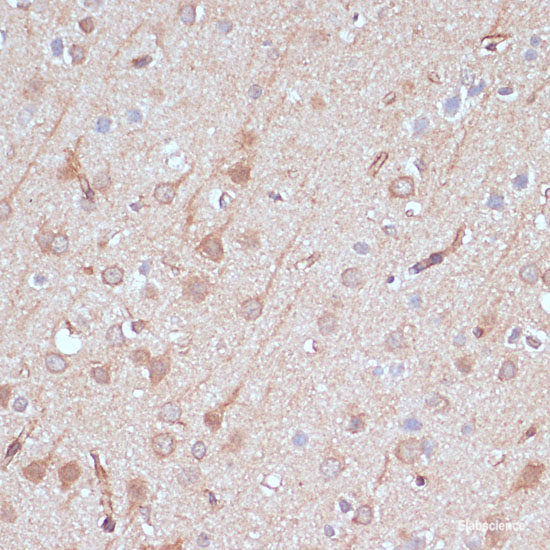 Immunofluorescence analysis of U2OS cells using STAT3 Polyclonal Antibody at dilution of  1:100. Blue: DAPI for nuclear staining.