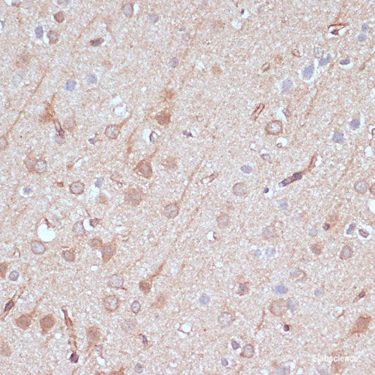 Immunofluorescence analysis of U2OS cells using STAT3 Polyclonal Antibody at dilution of  1:100. Blue: DAPI for nuclear staining.