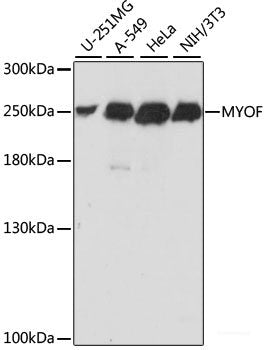 Immunofluorescence analysis of 293T cells using A2M Polyclonal Antibody at dilution of  1:100 (40x lens). Blue: DAPI for nuclear staining.